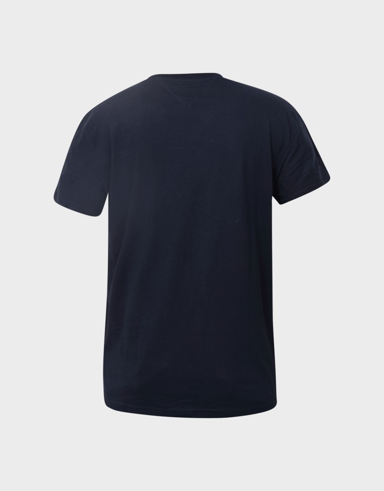 REGULAR ENTRY DNA TEE